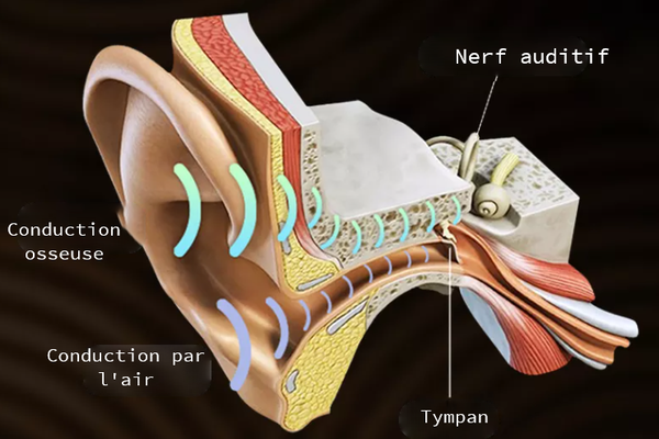Schéma du fonctionnement de la conduction osseuse